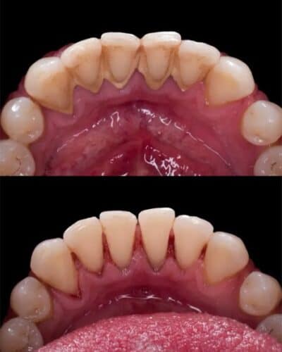 preventativecare_cleaning