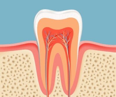 restorative_dentistry_rootcanaltherapy